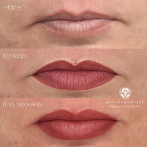 tokeletes ajaktetovalas wachter krisztina koszeg