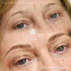 szalazott szemoldoktetovalas wachter krisztina koszeg